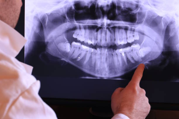 Best Emergency Tooth Extraction in Sundown, TX